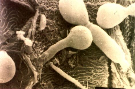 candida.jpg