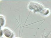 fibrin-szalak.jpg